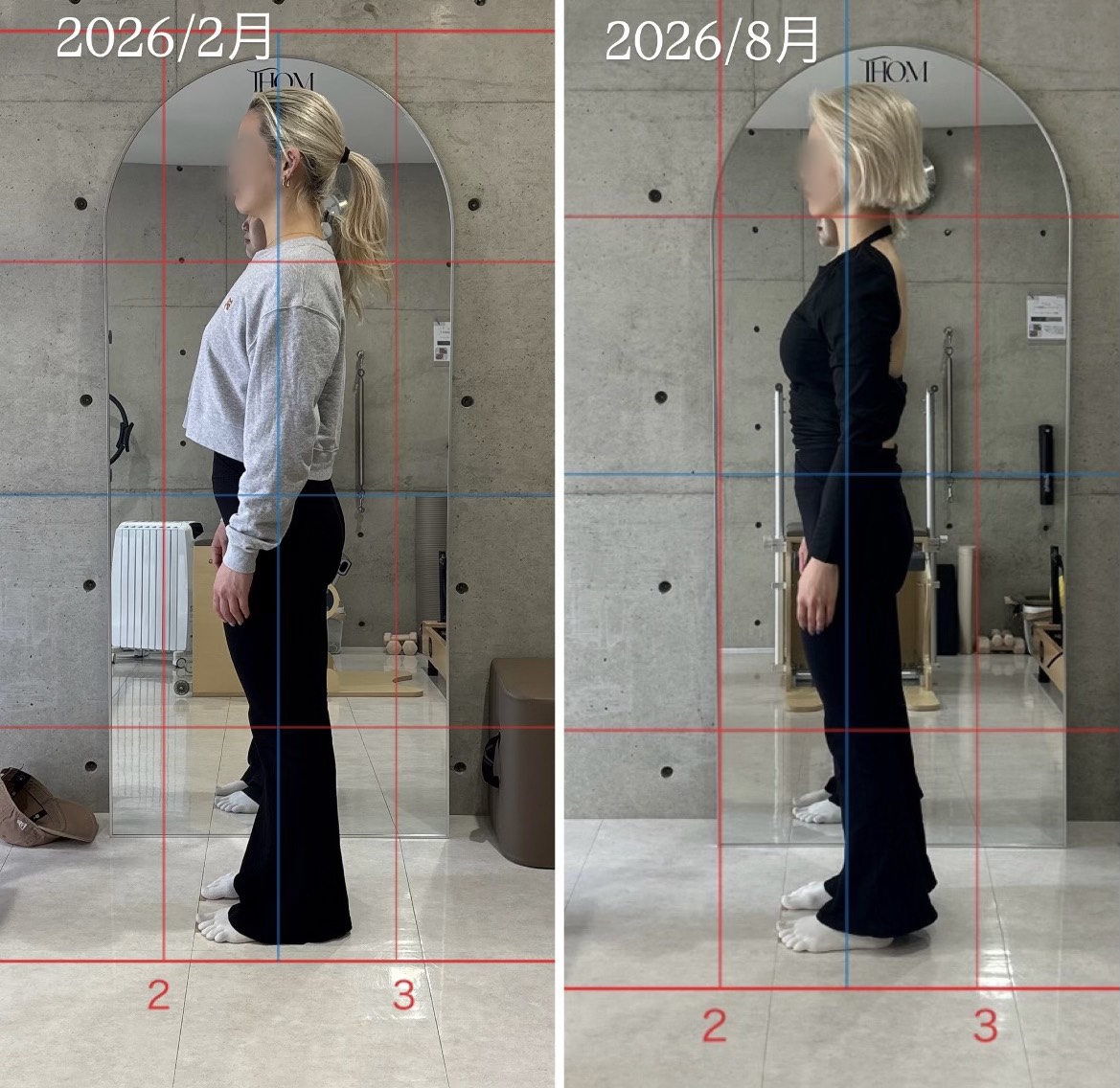 横から見た立ち姿のビフォーアフター写真。左が前、右が後。